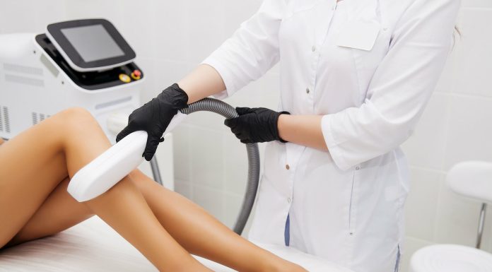 Что нужно знать о лазерном удалении волос